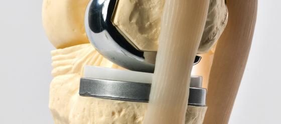 Medical - Knee Part Photo